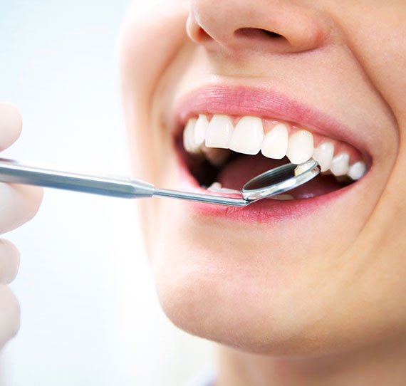 dental hygiene cleaning breslau dentist dental office