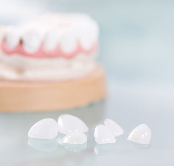 dental veneers breslau dentist dental office